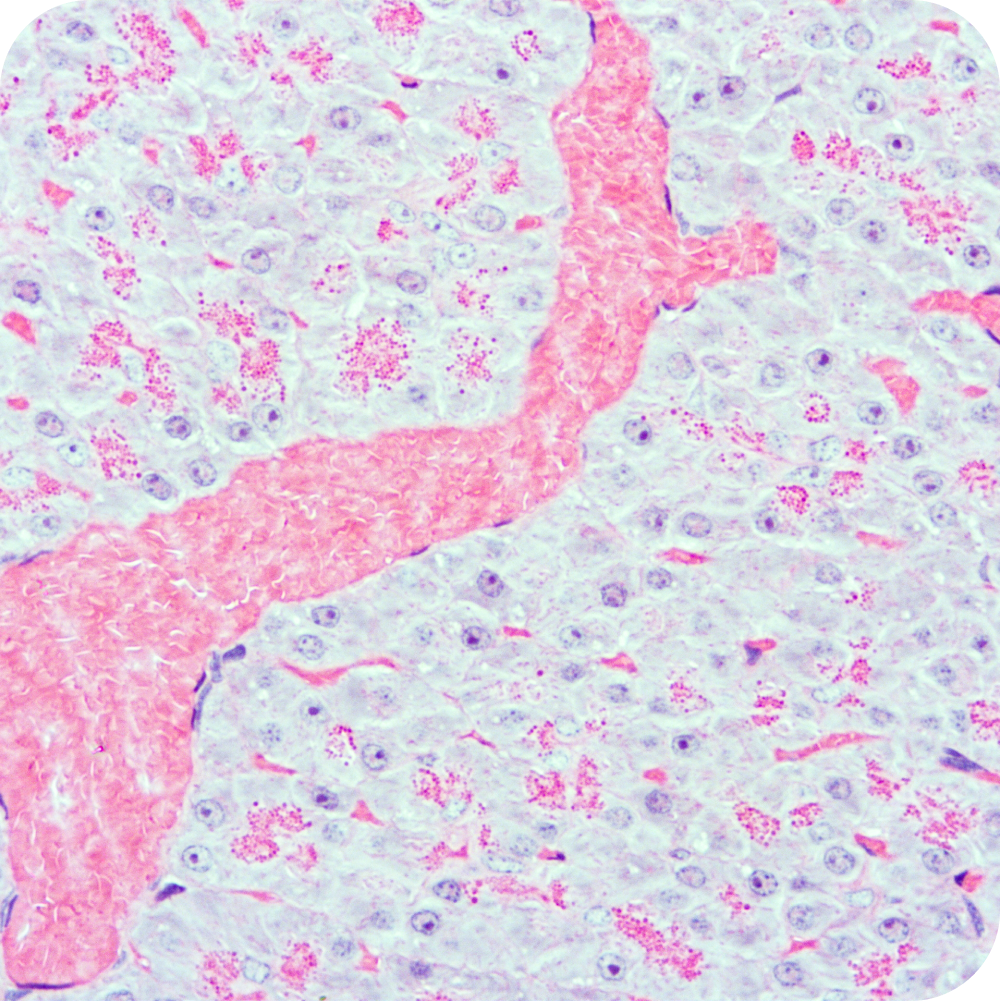 MAKOL-Inmunohistoquímica-2