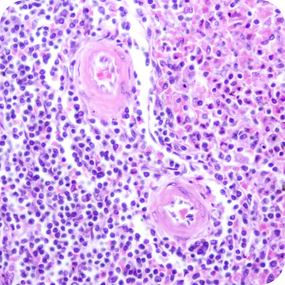 MAKOL-Inmunohistoquímica-3