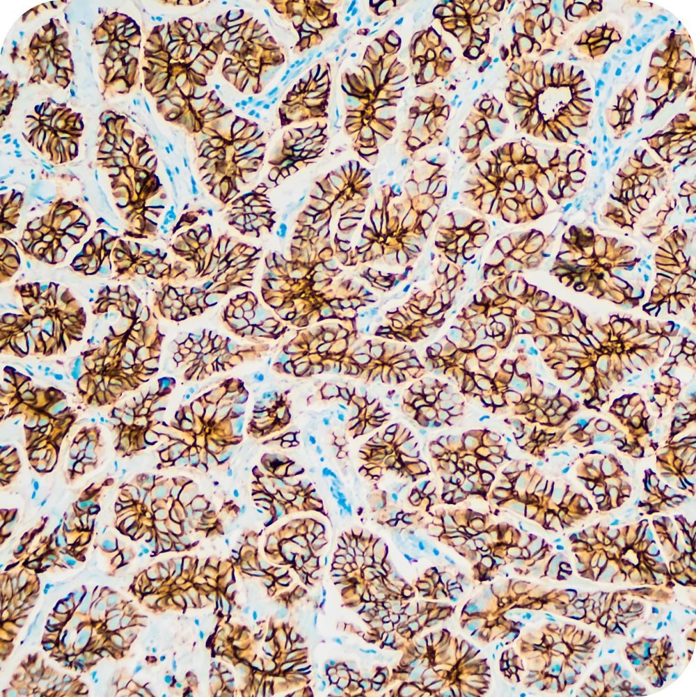 MAKOL-Inmunohistoquímica